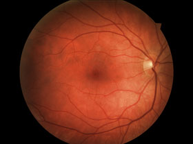 Eye examinations - London - University Vision Opticians - Eyeball